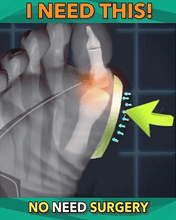 Load image into Gallery viewer, Bunion Sandals Correction Shoes Beauty And Health For Woman