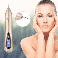 Load image into Gallery viewer, Warts Moles Skin Tags Remover Pen Accessories For Beauty Lovers