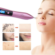 Load image into Gallery viewer, Warts Moles Skin Tags Remover Pen Accessories For Beauty Lovers