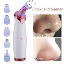 Load image into Gallery viewer, Blackhead Removal Tool Extractor Microdermabrasion Pore Vacuum Accessories For Beauty Lovers