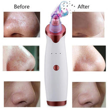 Load image into Gallery viewer, Blackhead Removal Tool Extractor Microdermabrasion Pore Vacuum Accessories For Beauty Lovers