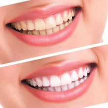 Load image into Gallery viewer, Advanced Teeth Whitening Kit For Professional LED Dental Treatment Beauty And Health For Everyone