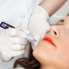 Load image into Gallery viewer, Warts Moles Skin Tags Remover Pen Accessories For Beauty Lovers
