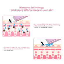 Load image into Gallery viewer, Ultrasonic Deep Skin Scrubber Decoration For Beauty Lovers
