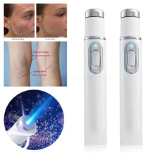 Load image into Gallery viewer, Blue Light Therapy Laser Pen Scar Acne Removal Accessories For Beauty Lovers
