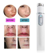 Load image into Gallery viewer, Blue Light Therapy Laser Pen Scar Acne Removal Accessories For Beauty Lovers

